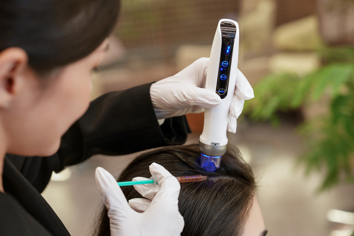 Medical microneedling on the scalp with IYASHI Exosomes