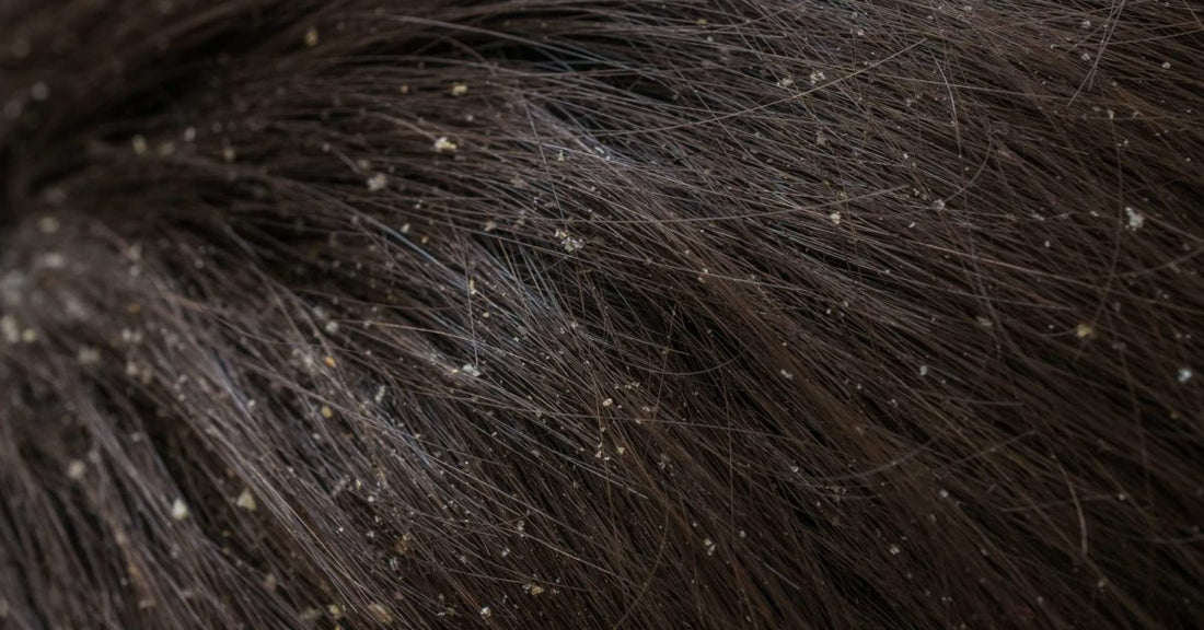 3 Common Types of Scalp Problems | TrichoLab