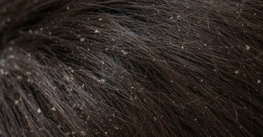3 Common Types of Scalp Problems | TrichoLab