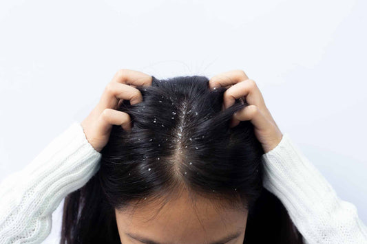 This is The Most Important Ingredient in Anti-dandruff Treatment