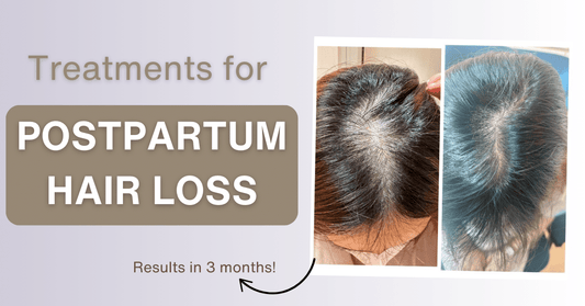 Postpartum Hair Loss: Treatment Options for New Mums