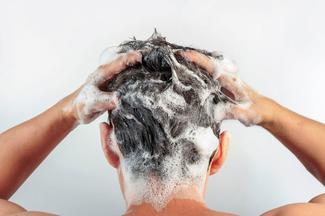 Is Shampoo Enough to Treat Scalp Acne?