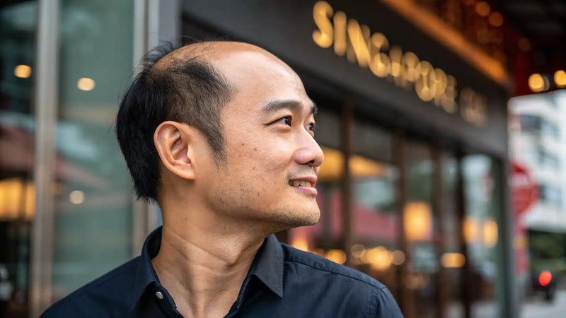 A man with thinning hair across the top of his scalp