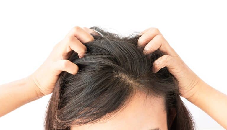 common scalp problems