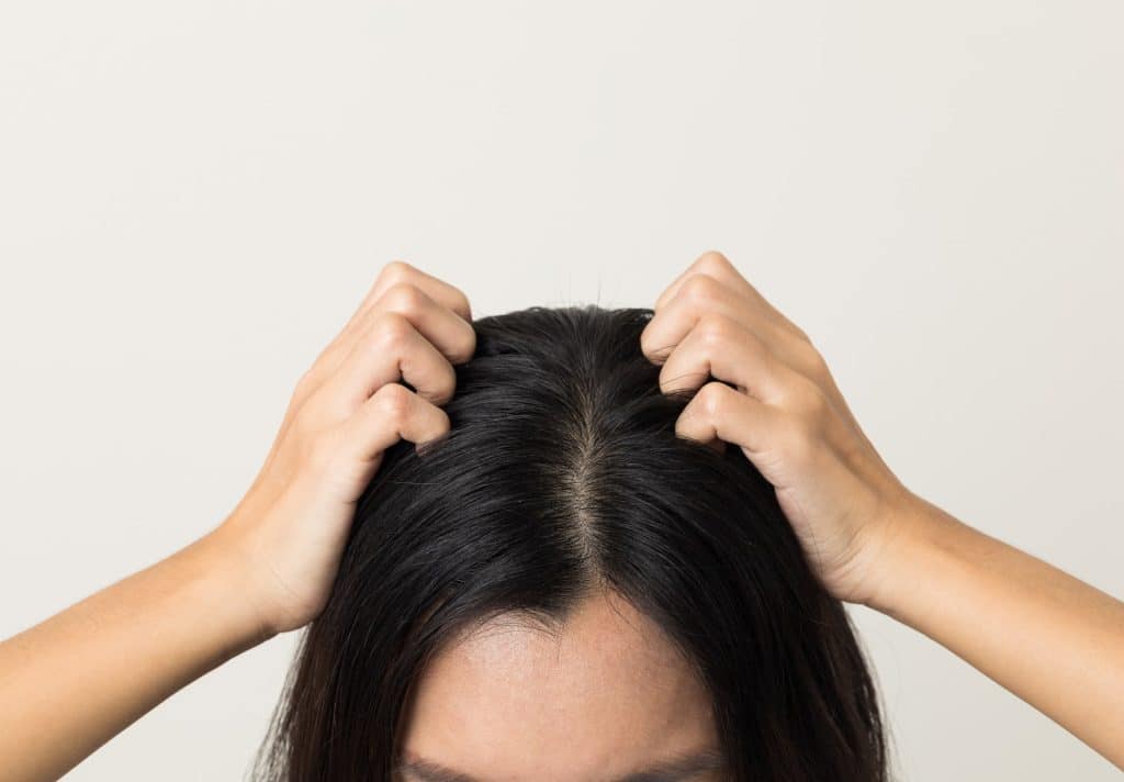 Woman with itchy scalp scratching her hair.