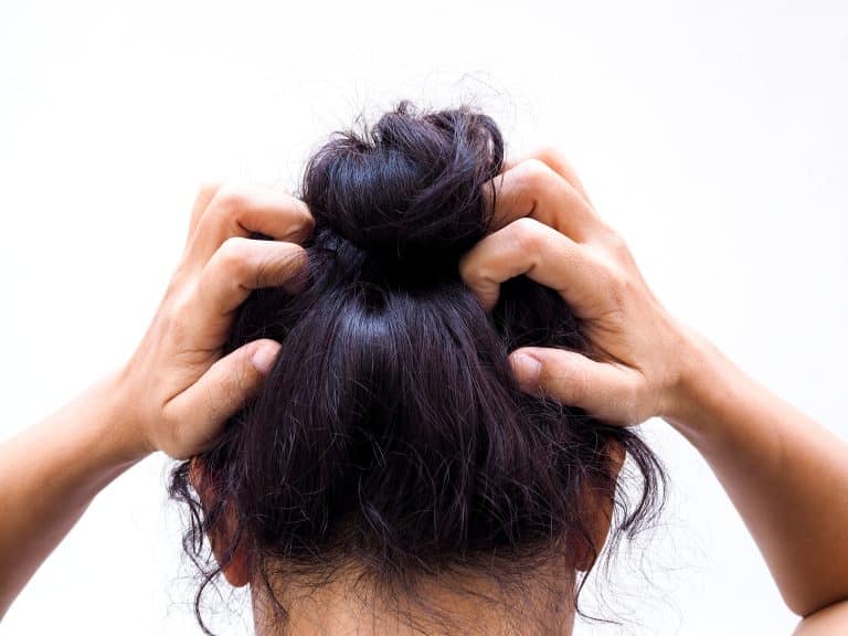 A woman scratching her itchy and irritated scalp