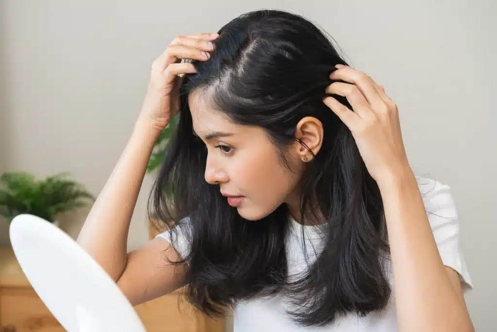 Girl noticing dandruff flakes on her scalp