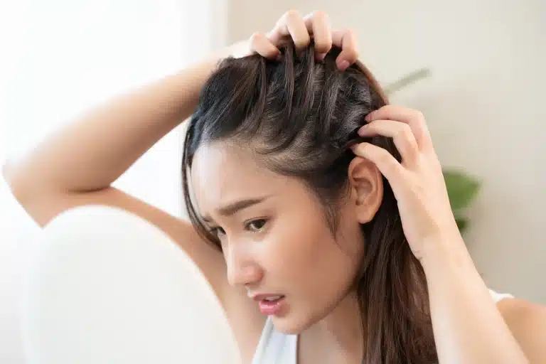 Woman struggling with scalp eczema symptoms.